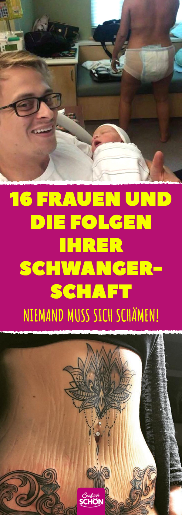 16 Mütter zeigen Körper nach Schwangerschaft