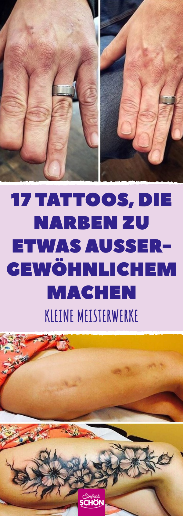 16 Tattoos, die Narben zu etwas Außergewöhnlichem machen