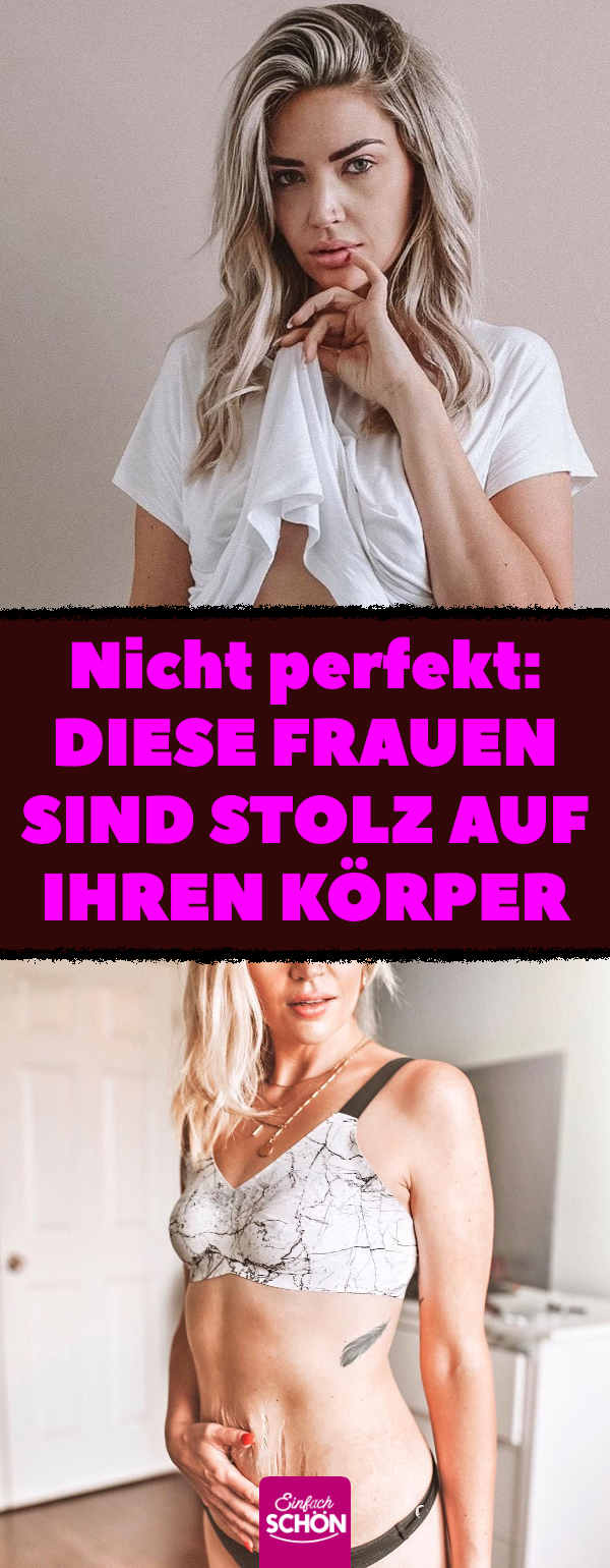 Nicht perfekt: Diese Frauen sind stolz auf ihren Körper