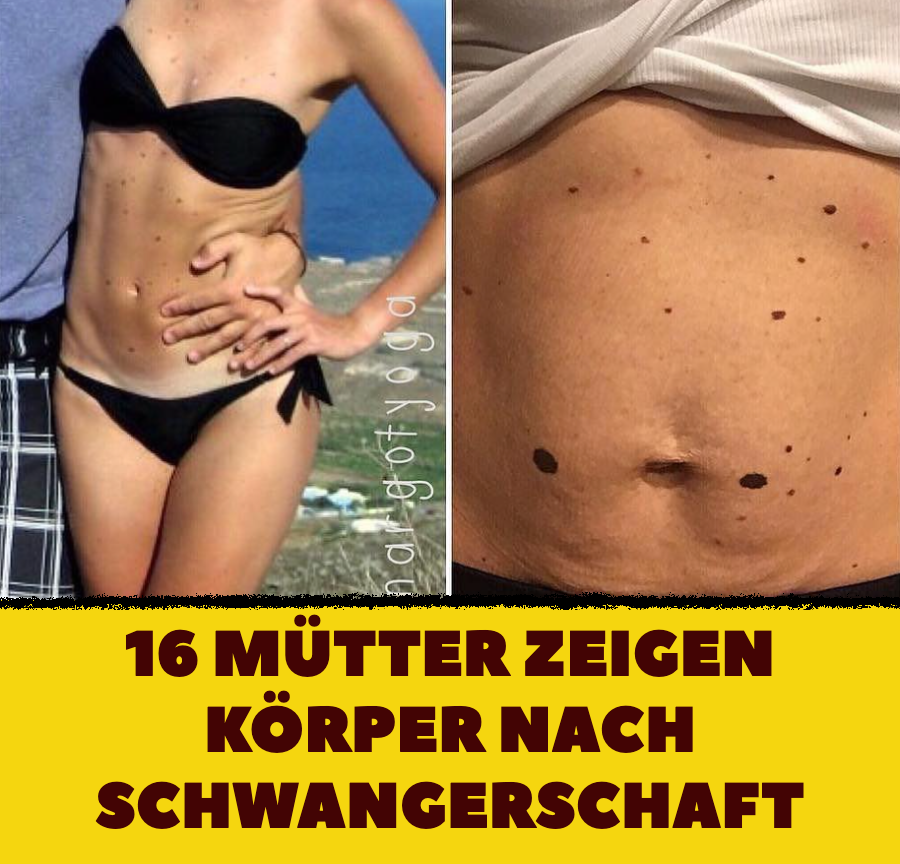 16 Mütter zeigen Körper nach Schwangerschaft