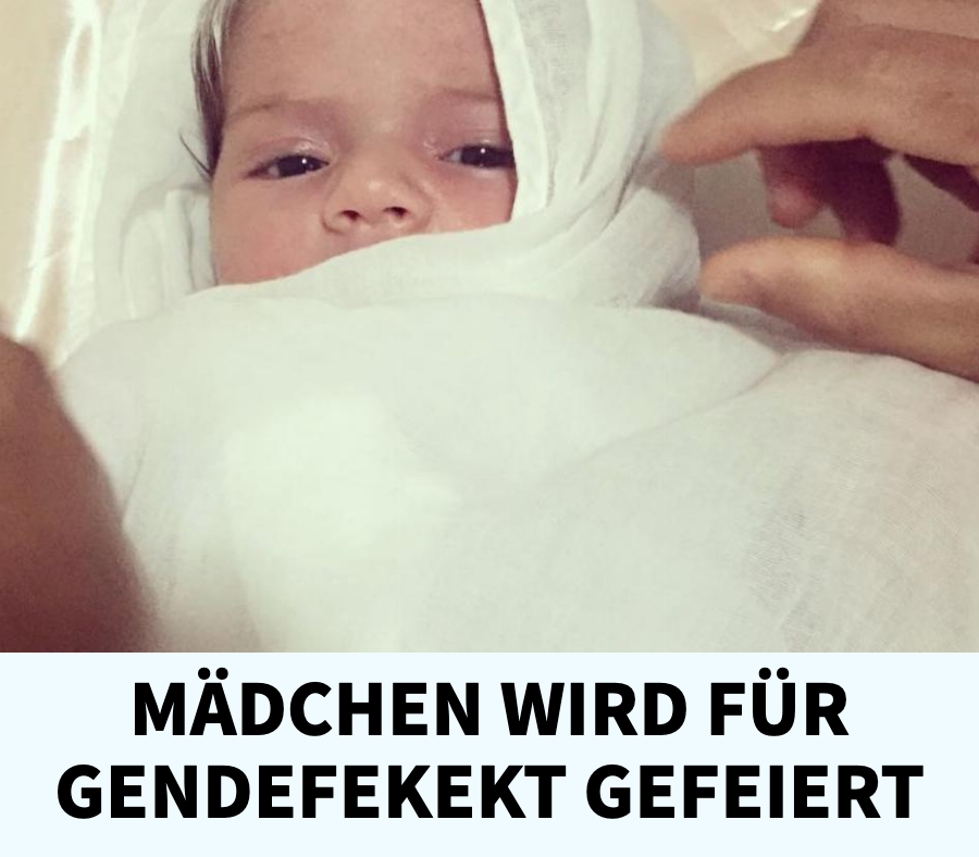 Piebaldismus: Baby Mayah wird mit weißer Strähne geboren