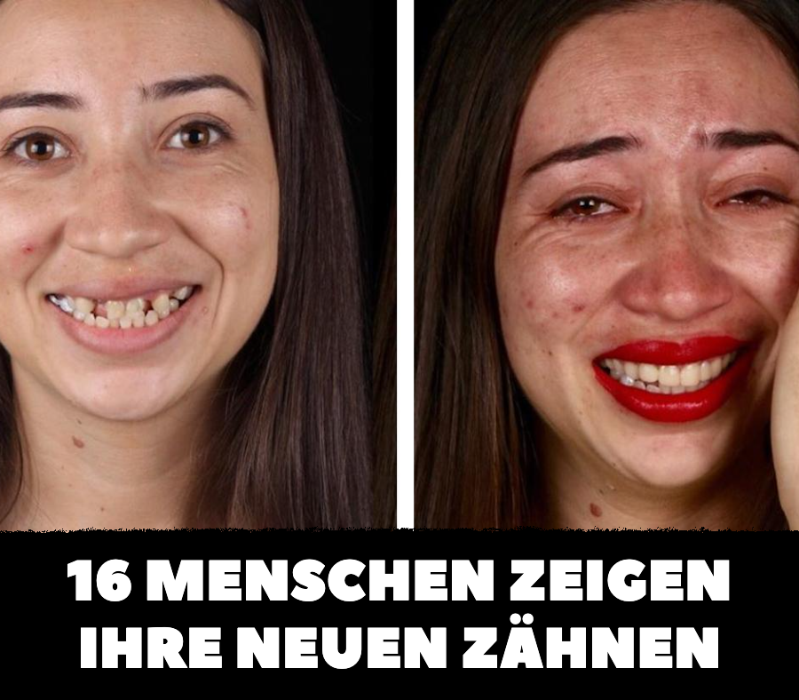 16 Vorher-nachher-Bilder von Menschen mit neuen Zähnen