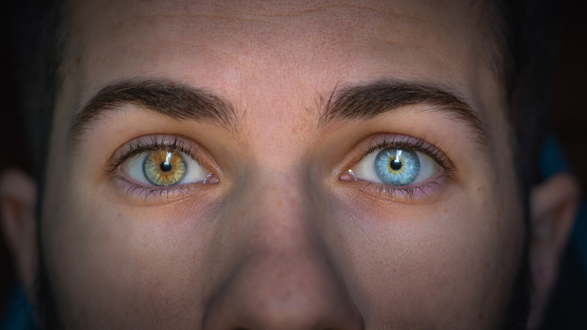 Ein Porträt von einem Menschen mit Heterochromie.