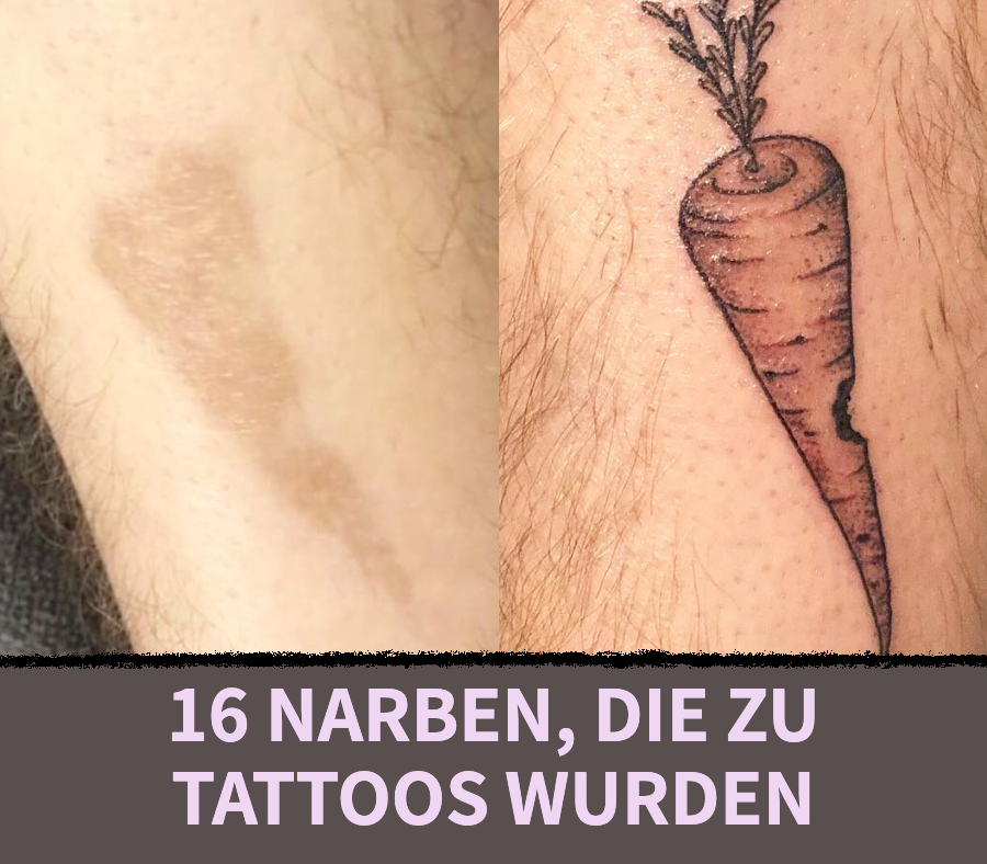 16 Tattoos, die Narben zu etwas Außergewöhnlichem machen