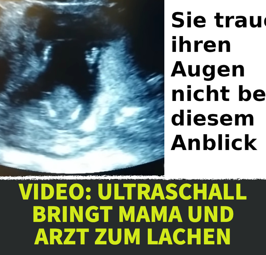 Video: Ultraschall bringt Mama und Arzt zum Lachen