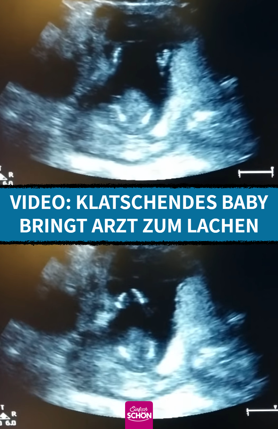 Video: Ultraschall bringt Mama und Arzt zum Lachen