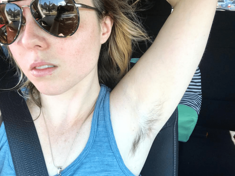Frau mit Sonnenbrille zeigt haarige Achsel