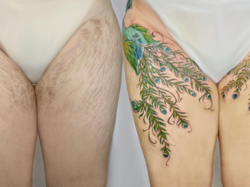 tattoos-kuenstlerin-ueberdeckt-narben-ngoc-like-tbn