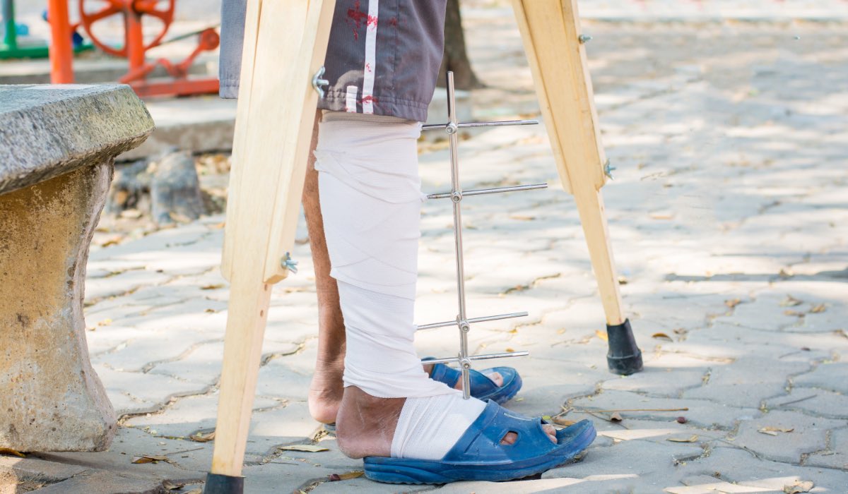 Ein Mann in Gips und Krücken in einem Park.